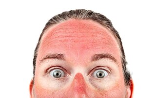 Pourquoi attrape-t-on des coups de soleil ?